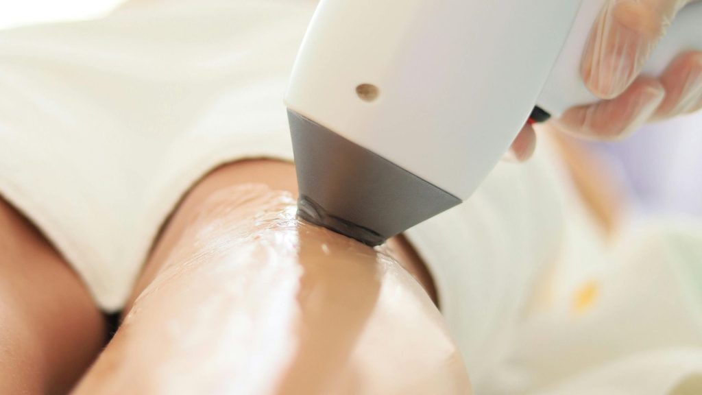 Có bầu triệt lông bikini được không Câu trả lời từ chuyên gia LiA Spa