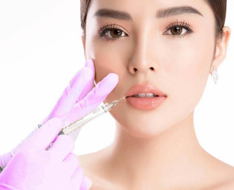 [Review] 5 Câu Hỏi Thường Gặp Của Chị Em Về Tiêm Filler Tự Tan (2)