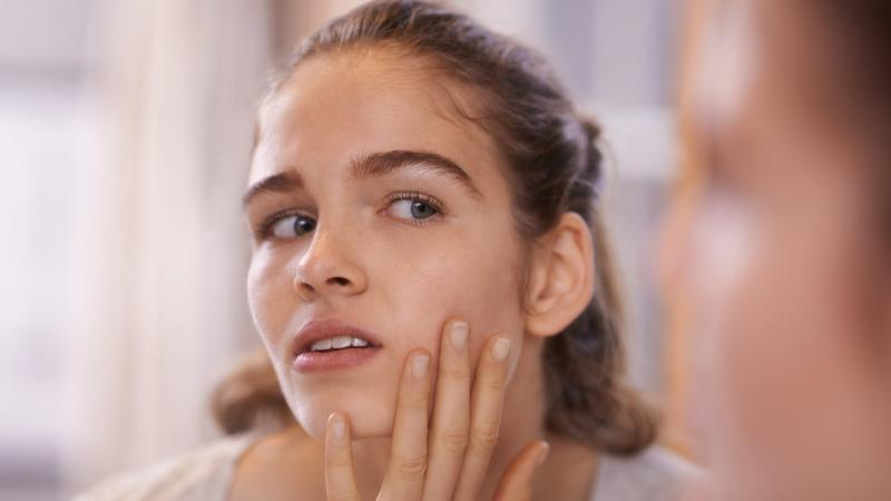 Thói Quen Sờ Tay Lên Mặt – “Thủ Phạm Ngầm” Gây Mụn Mà Bạn Không Ngờ Tới