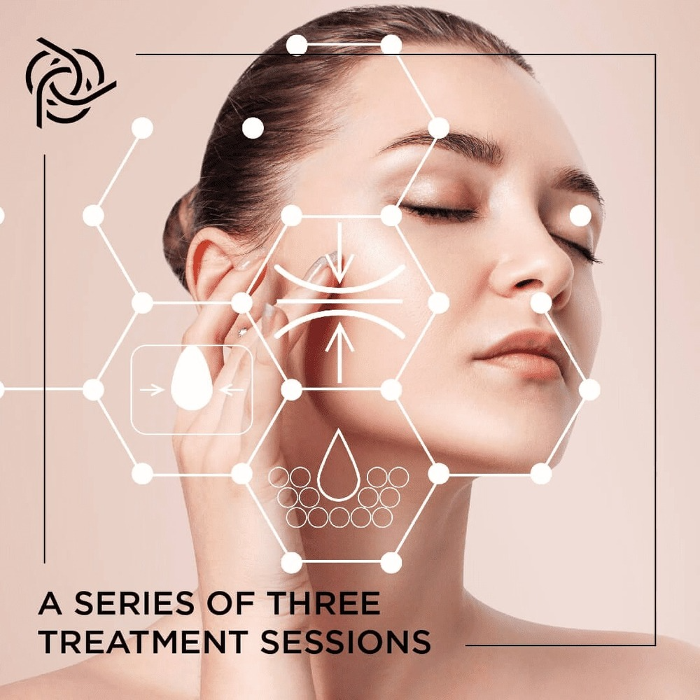 Tre Hoa Da Bang Cong Nghe Cao 5 Phuong Phap Tot Nhat Hien Nay 1