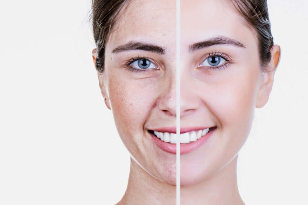 Trẻ Hóa Da Là Gì Giải Pháp Giữ Mãi Thanh Xuân Chuẩn Y Khoa Tại LiA Spa (1)