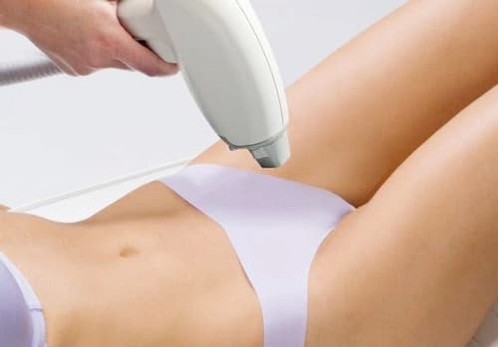 Triệt Lông Bikini Bị Nổi Mụn Có Sao Không Cách Khắc Phục Chuẩn Y Khoa Từ LiA Spa & Beauty