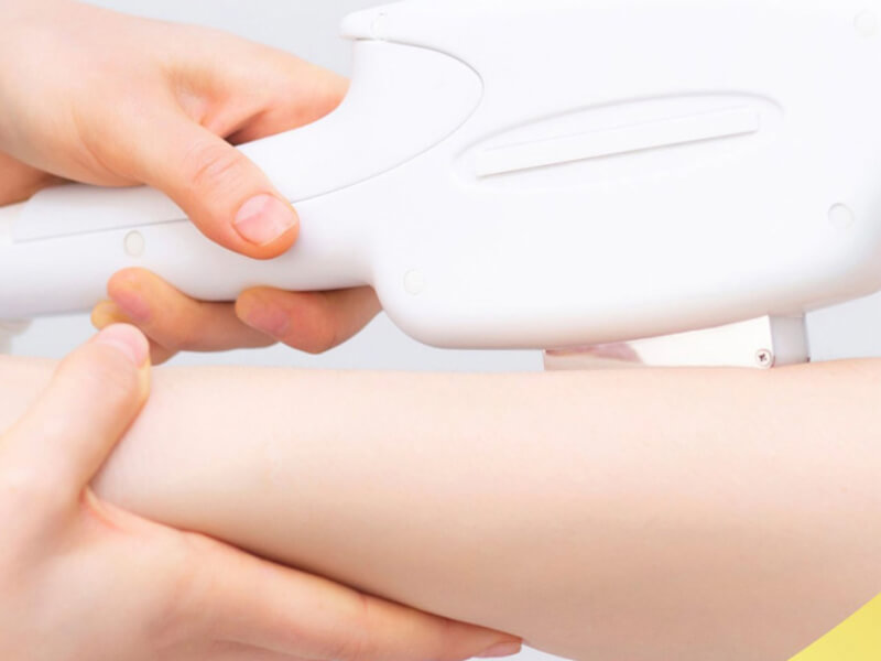 Triệt Lông Có Thu Nhỏ Lỗ Chân Lông Không Sự Thật Cần Làm Rõ