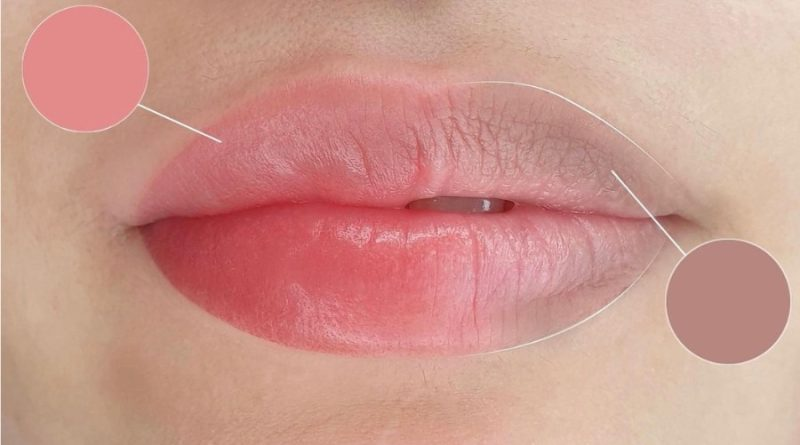 Khử Thâm Môi Công Nghệ Cao – Giải Pháp Cho Đôi Môi Hồng Hào