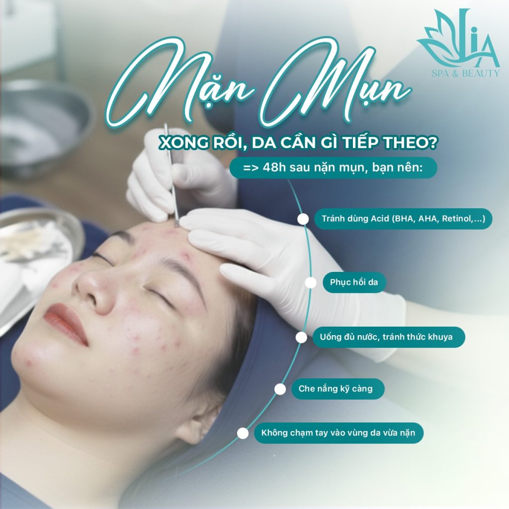 Liệu Trình Trị Mụn Có Thực Sự Hiệu Quả Chỉ Trong Một Lần Điều Trị