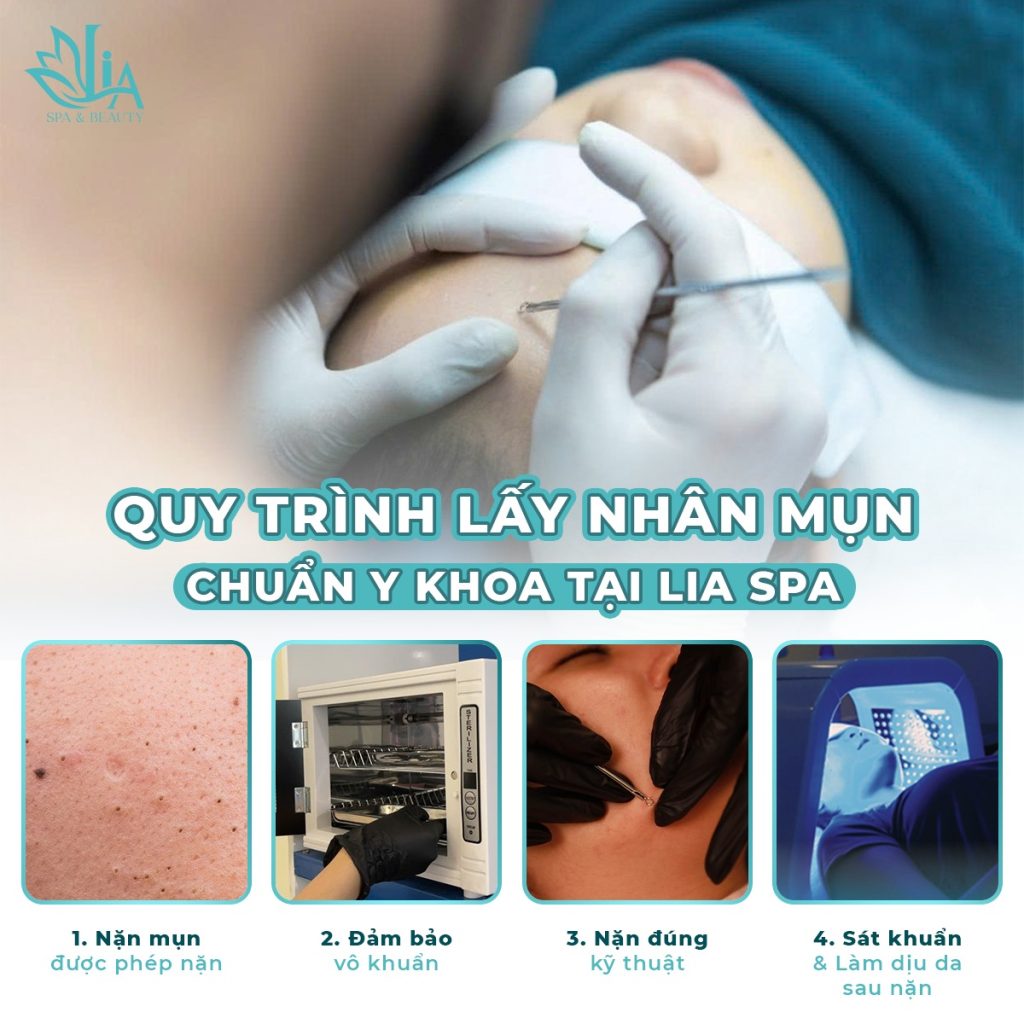 Liệu Trình Trị Mụn Có Thực Sự Hiệu Quả Chỉ Trong Một Lần Điều Trị