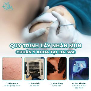 Liệu Trình Trị Mụn Có Thực Sự Hiệu Quả Chỉ Trong Một Lần Điều Trị