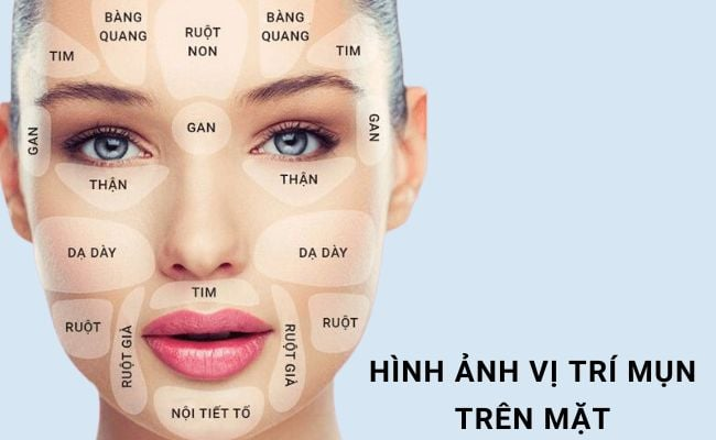 Vị Trí Mọc Mụn Cảnh Báo Tình Trạng Sức Khỏe Của Bạn – Gợi Ý Từ LiA Spa & Beauty