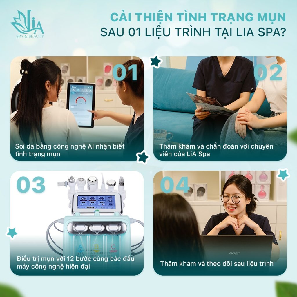 Xử Lý Nhân Mụn Chuẩn Y Khoa Tại LiA Spa Tân Phú An Toàn – Không Xâm Lấn (1)
