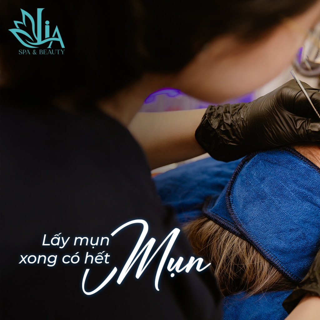 Trị Mụn Công Nghệ Cao Tân Phú – Không Xâm Lấn, An Toàn Cho Da LiA Spa (1)